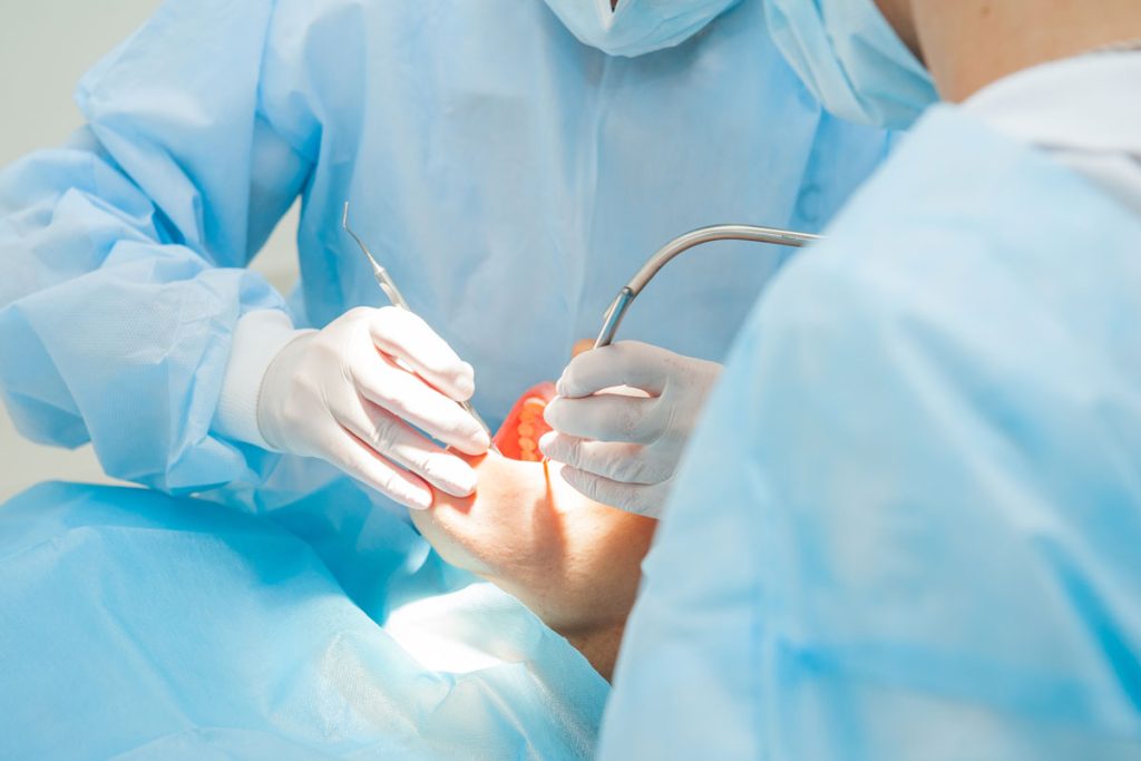 Chirurgia Orale per parodontologia