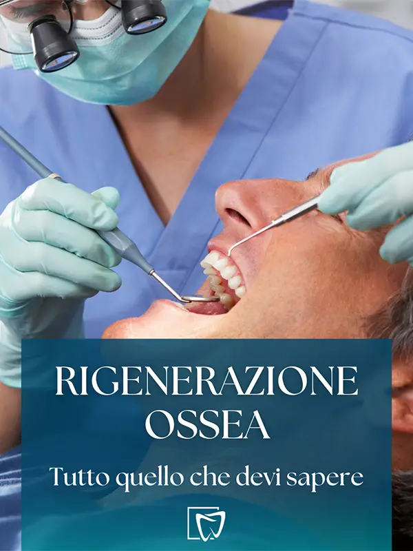 Elite Odontoiatrica - Rigenerazione ossea