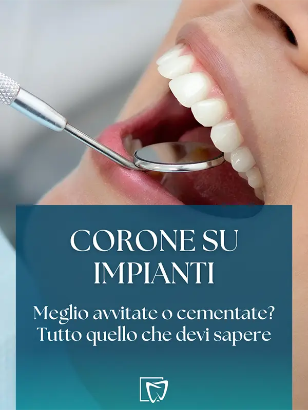 Protesi su impianti